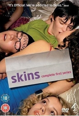 스킨스